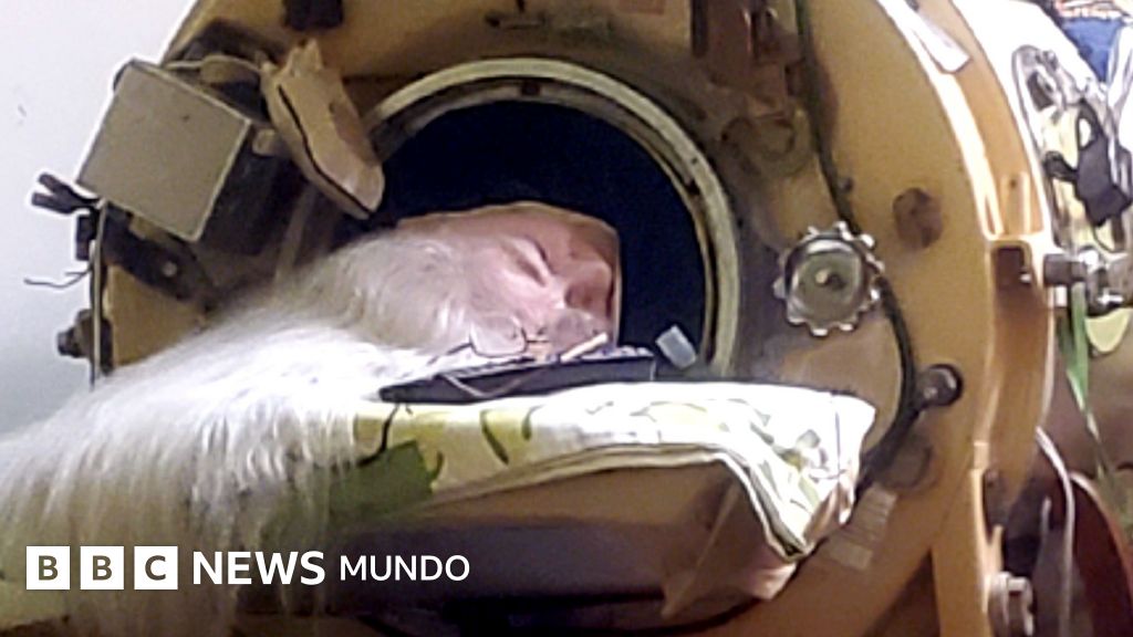 Imagen para: La inspiradora historia de Martha Lillard: 73 años en un pulmón de acero